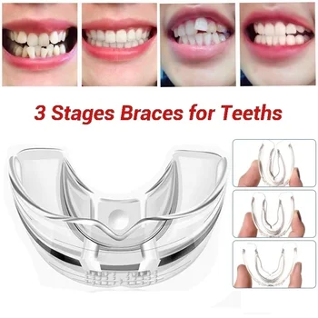 3 Etapus Dantų Ortodontinis Dantų Silikono Petnešos Aparatas Treneris Korektorius Derinimas Treneris Dantų Suaugusiųjų Dantų Priežiūros Priemonė