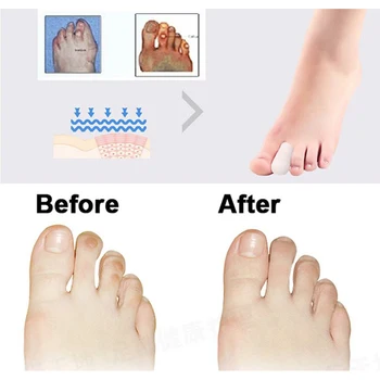 8Pcs Moterų Silikono Gelis, Vamzdžių Piršto Kojų Apsaugų lizdinės plokštelės Apsaugo Kojų Pėdų Skausmą Kojų Priežiūros, Kojų Priežiūros Produktas C477
