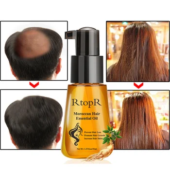Maroko Plaukų Augimą eterinis Aliejus Kovos su Plaukų Slinkimas Produktas, 35ml Žalą Sausų Plaukų Priežiūros Slaugos eterinio Aliejaus Serumas Greitai Plaukų Augimą