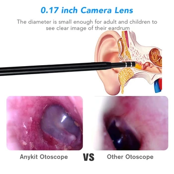 Medicinos Ausų Valymo Endoskopą Šaukštas Mini Kamera Ausies Picker Ausų Vaško Šalinimo Vaizdo Ausį, Burną, Nosį Otoscope Parama Android PC