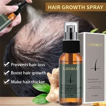 Plaukų Augimo Esmė Aliejus, Plaukų Slinkimas Gydymo Padėti dėl plaukų Augimą, Plaukų Priežiūros 30ml Plaukų Augimą Purškimo Imbieras Esmė Spray