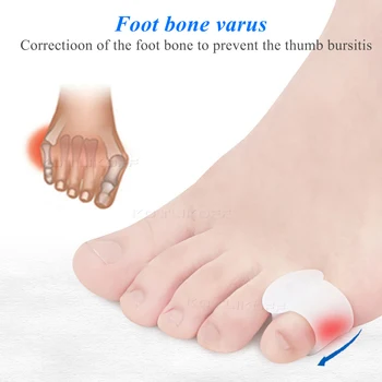 Silikono Gelis Mažų Kojų Separatorius siekiant Išvengti Kojų Pusėje Sutampa Hallux Valgus Korektorius Nykščio Apsauga Ortopedinių Įdėklų Pagalvėlės